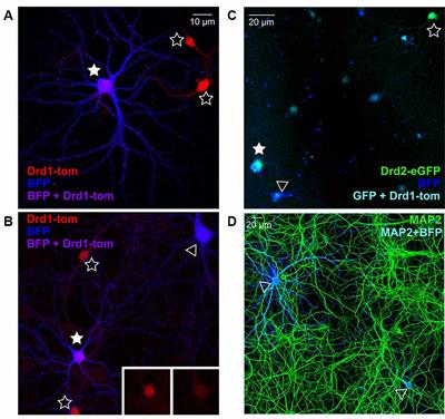 Chronic and Acute Manipulation of Cortical Glutamate Transmission Induces Structural and Synaptic Changes in Co-cultured Striatal Neurons